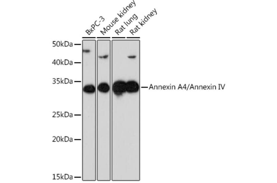 Western Blot - Anti-Annexin-4/ANXA4 Antibody [ARC1477] (A307061) - Antibodies.com