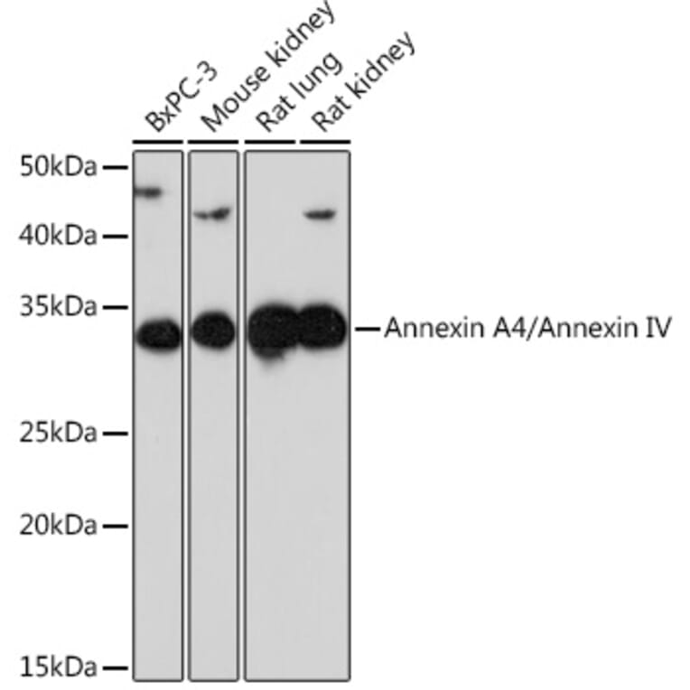 Western Blot - Anti-Annexin-4/ANXA4 Antibody [ARC1477] (A307061) - Antibodies.com