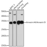 Western Blot - Anti-Annexin-4/ANXA4 Antibody [ARC1477] (A307061) - Antibodies.com