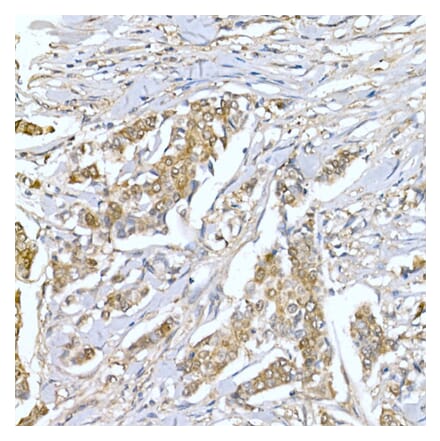 Immunohistochemistry - Anti-Lactate Dehydrogenase Antibody (A307063) - Antibodies.com