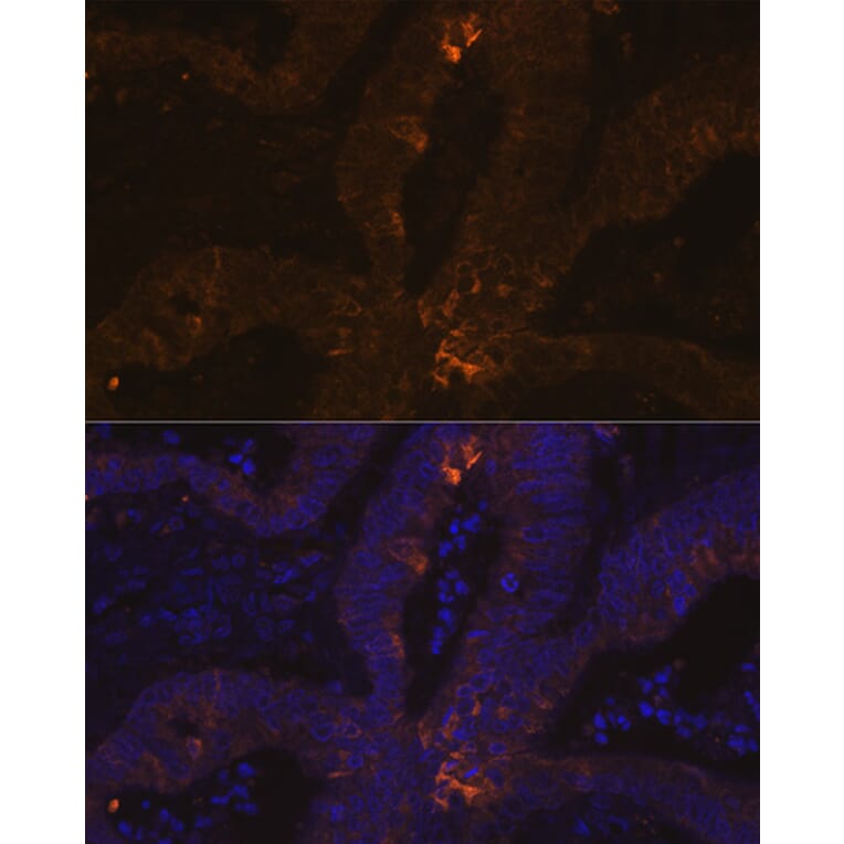 Immunofluorescence - Anti-Estrogen Inducible Protein pS2 Antibody [ARC1427] (A307065) - Antibodies.com