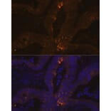 Immunofluorescence - Anti-Estrogen Inducible Protein pS2 Antibody [ARC1427] (A307065) - Antibodies.com