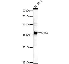 Western Blot - Anti-Retinoic Acid Receptor gamma Antibody (A307066) - Antibodies.com