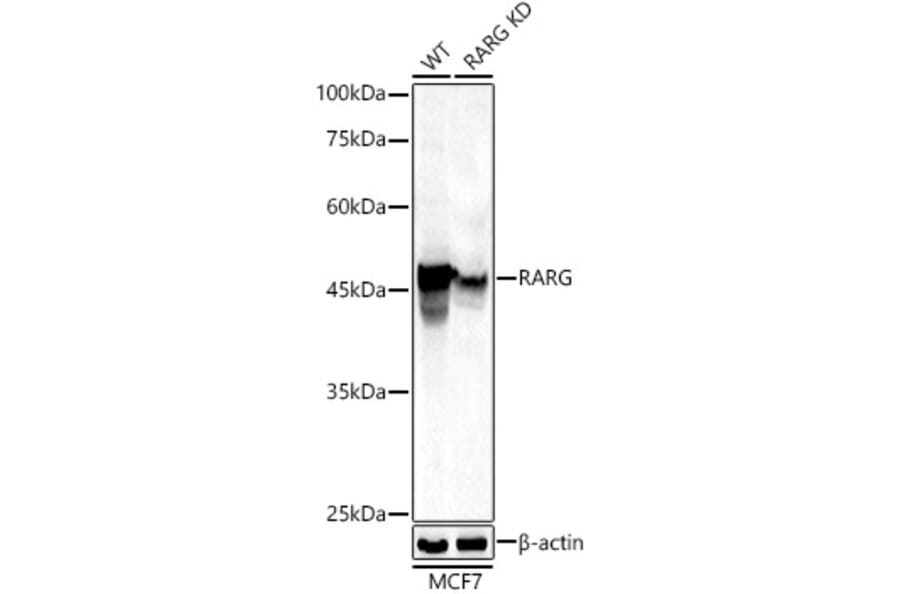 Western Blot - Anti-Retinoic Acid Receptor gamma Antibody (A307066) - Antibodies.com