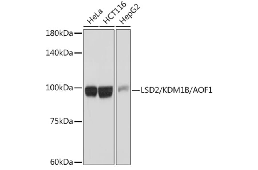 Western Blot - Anti-LSD2/AOF1 Antibody [ARC2347] (A307067) - Antibodies.com