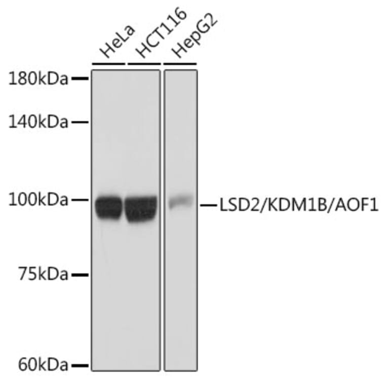 Western Blot - Anti-LSD2/AOF1 Antibody [ARC2347] (A307067) - Antibodies.com