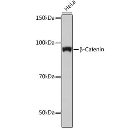 Western Blot - Anti-beta Catenin Antibody [ARC0136] (A307069) - Antibodies.com