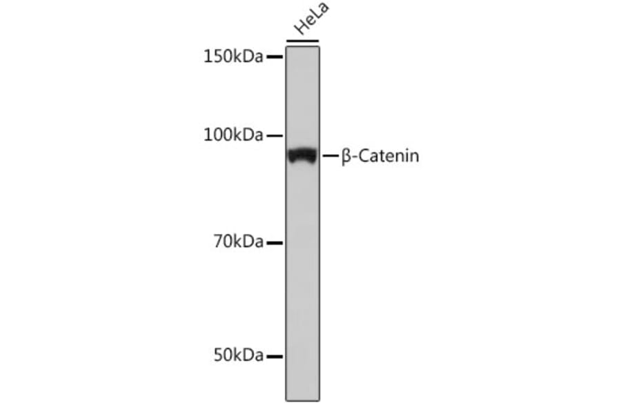 Western Blot - Anti-beta Catenin Antibody [ARC0136] (A307069) - Antibodies.com