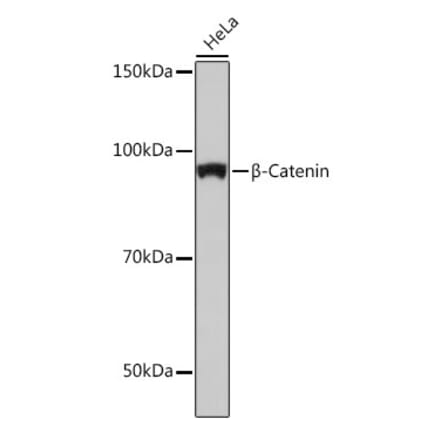 Western Blot - Anti-beta Catenin Antibody [ARC0136] (A307069) - Antibodies.com