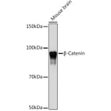 Western Blot - Anti-beta Catenin Antibody [ARC0136] (A307069) - Antibodies.com