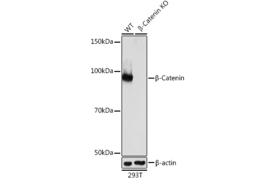 Western Blot - Anti-beta Catenin Antibody [ARC0136] (A307069) - Antibodies.com