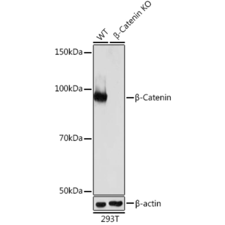 Western Blot - Anti-beta Catenin Antibody [ARC0136] (A307069) - Antibodies.com