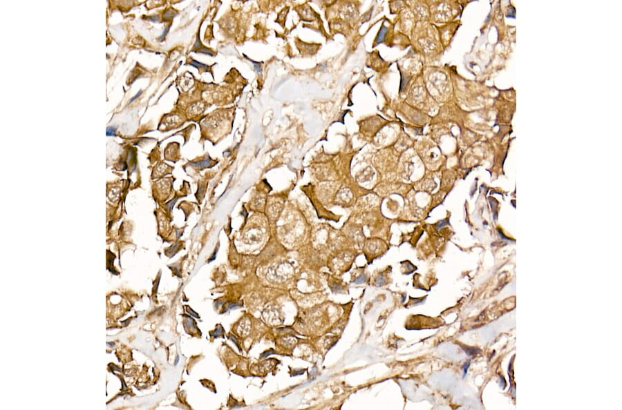 Immunohistochemistry - Anti-beta Catenin Antibody [ARC0136] (A307069) - Antibodies.com