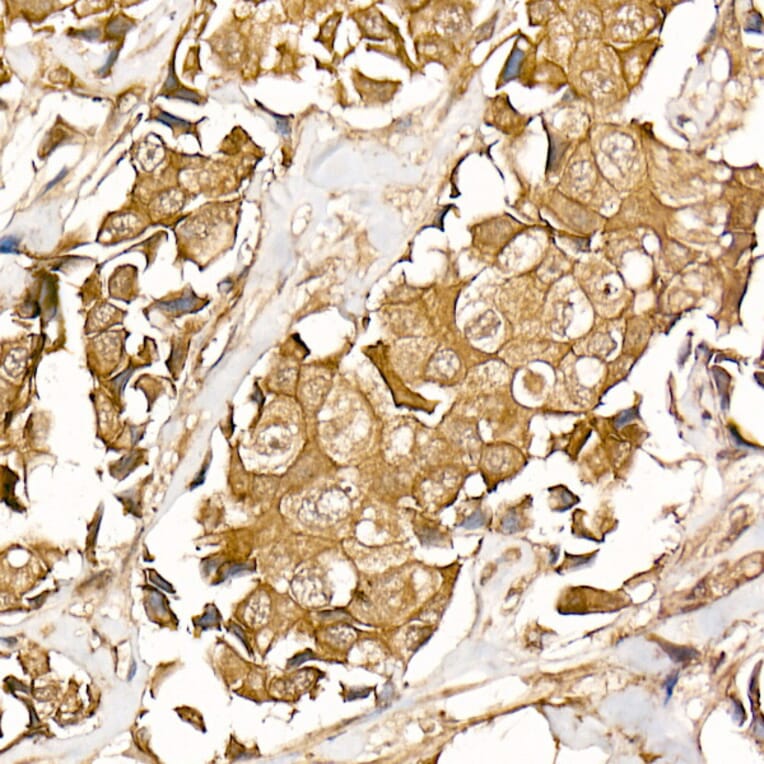 Immunohistochemistry - Anti-beta Catenin Antibody [ARC0136] (A307069) - Antibodies.com