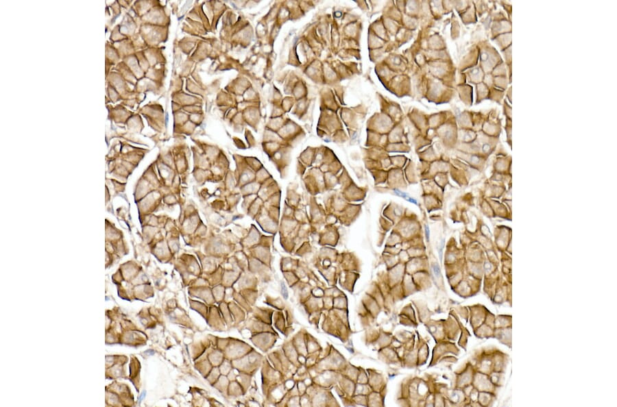 Immunohistochemistry - Anti-beta Catenin Antibody [ARC0136] (A307069) - Antibodies.com