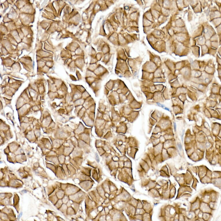 Immunohistochemistry - Anti-beta Catenin Antibody [ARC0136] (A307069) - Antibodies.com