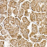 Immunohistochemistry - Anti-beta Catenin Antibody [ARC0136] (A307069) - Antibodies.com