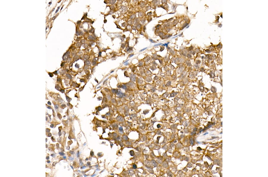 Immunohistochemistry - Anti-beta Catenin Antibody [ARC0136] (A307069) - Antibodies.com
