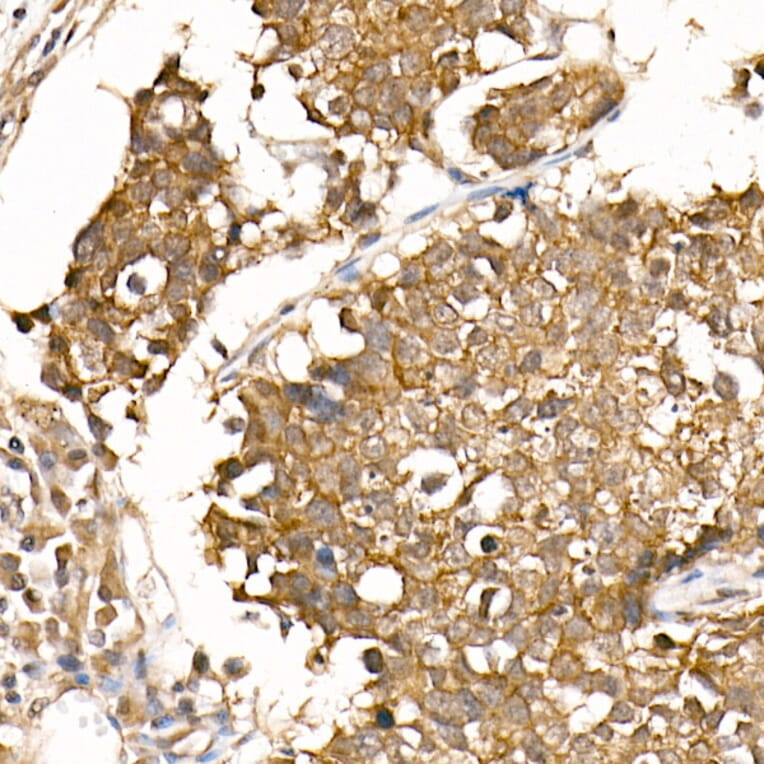 Immunohistochemistry - Anti-beta Catenin Antibody [ARC0136] (A307069) - Antibodies.com