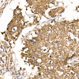 Immunohistochemistry - Anti-beta Catenin Antibody [ARC0136] (A307069) - Antibodies.com