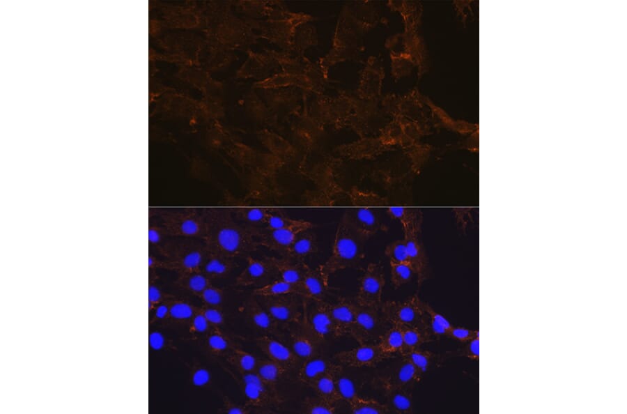Immunofluorescence - Anti-beta Catenin Antibody [ARC0136] (A307069) - Antibodies.com