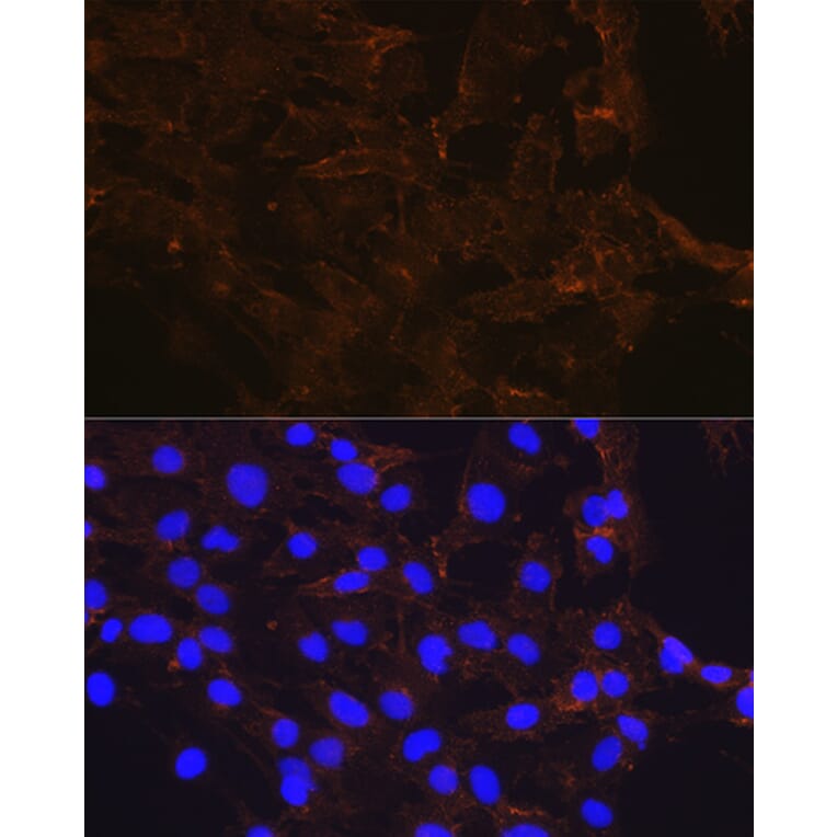 Immunofluorescence - Anti-beta Catenin Antibody [ARC0136] (A307069) - Antibodies.com