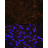 Immunofluorescence - Anti-beta Catenin Antibody [ARC0136] (A307069) - Antibodies.com
