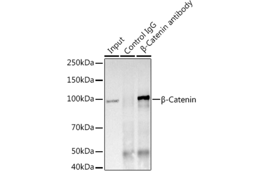 Western Blot - Anti-beta Catenin Antibody [ARC0136] (A307069) - Antibodies.com