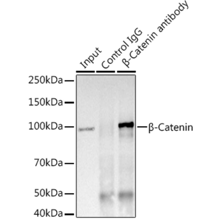 Western Blot - Anti-beta Catenin Antibody [ARC0136] (A307069) - Antibodies.com