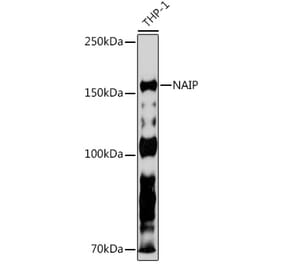 Western Blot - Anti-NAIP Antibody [ARC2258] (A307070) - Antibodies.com