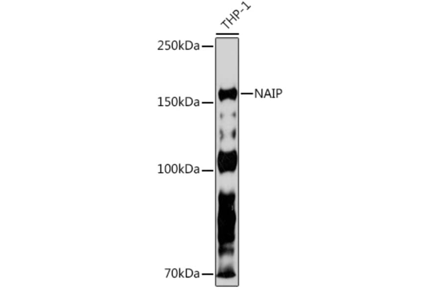 Western Blot - Anti-NAIP Antibody [ARC2258] (A307070) - Antibodies.com