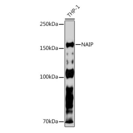 Western Blot - Anti-NAIP Antibody [ARC2258] (A307070) - Antibodies.com