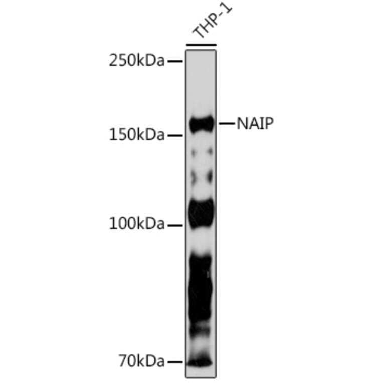 Western Blot - Anti-NAIP Antibody [ARC2258] (A307070) - Antibodies.com