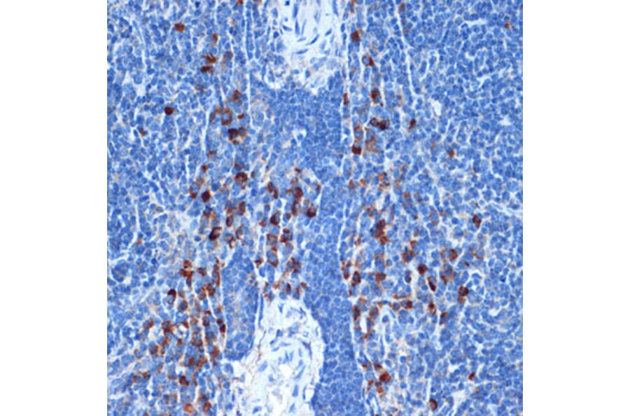 Immunohistochemistry - Anti-NAIP Antibody [ARC2258] (A307070) - Antibodies.com