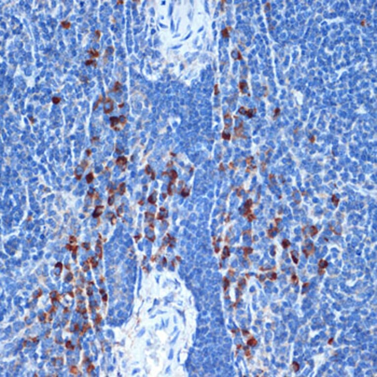Immunohistochemistry - Anti-NAIP Antibody [ARC2258] (A307070) - Antibodies.com