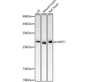 Western Blot - Anti-HPRT Antibody (A307072) - Antibodies.com