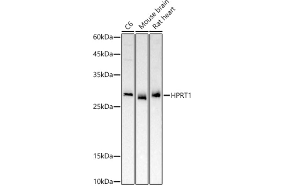 Western Blot - Anti-HPRT Antibody (A307072) - Antibodies.com