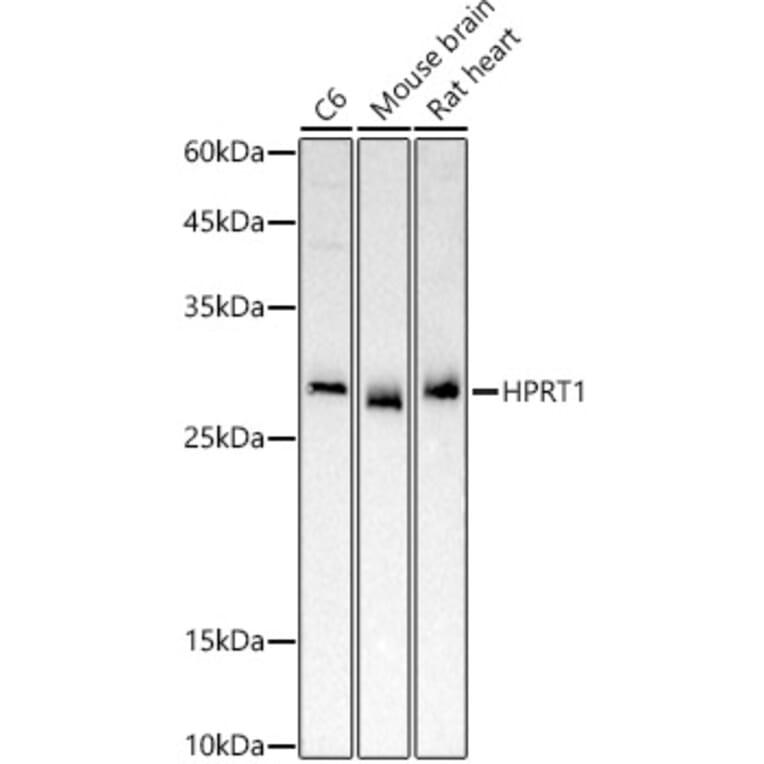 Western Blot - Anti-HPRT Antibody (A307072) - Antibodies.com