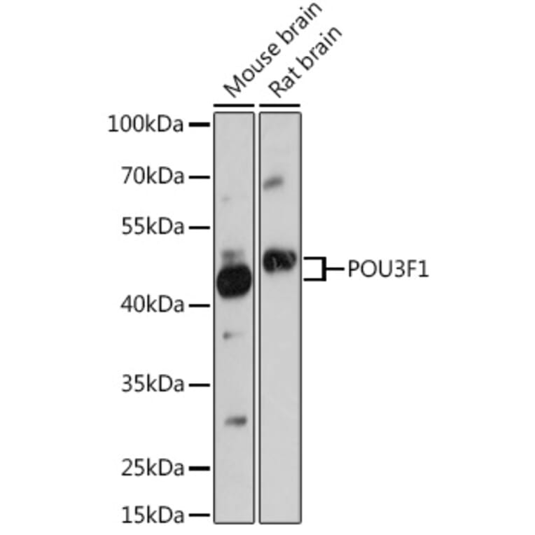 Western Blot - Anti-Oct6 Antibody (A307073) - Antibodies.com