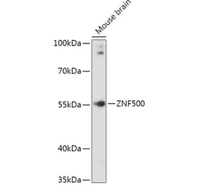 Western Blot - Anti-ZNF500 Antibody (A307075) - Antibodies.com