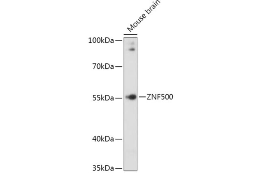Western Blot - Anti-ZNF500 Antibody (A307075) - Antibodies.com