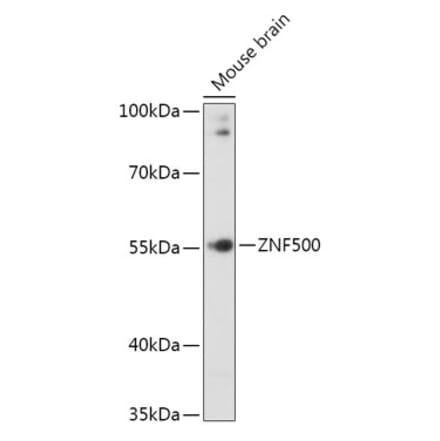 Western Blot - Anti-ZNF500 Antibody (A307075) - Antibodies.com