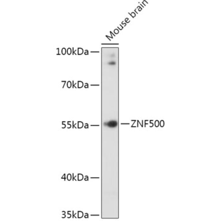 Western Blot - Anti-ZNF500 Antibody (A307075) - Antibodies.com