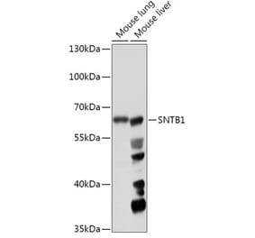 Western Blot - Anti-SNTB1 Antibody (A307076) - Antibodies.com