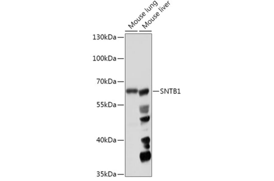 Western Blot - Anti-SNTB1 Antibody (A307076) - Antibodies.com