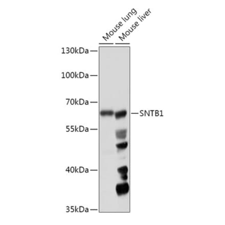 Western Blot - Anti-SNTB1 Antibody (A307076) - Antibodies.com