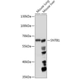 Western Blot - Anti-SNTB1 Antibody (A307076) - Antibodies.com