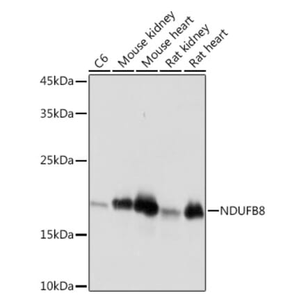 Western Blot - Anti-NDUFB8 Antibody [ARC2259] (A307077) - Antibodies.com