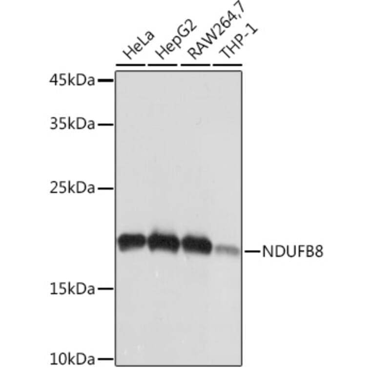 Western Blot - Anti-NDUFB8 Antibody [ARC2259] (A307077) - Antibodies.com