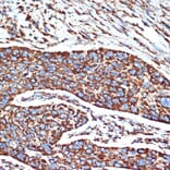 Immunohistochemistry - Anti-NDUFB8 Antibody [ARC2259] (A307077) - Antibodies.com
